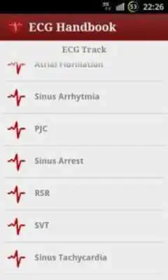 Play Heart ECG Handbook - Lite