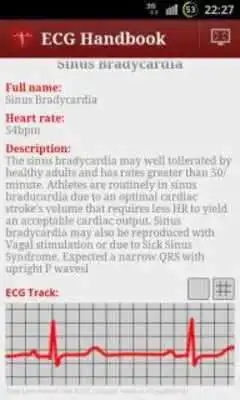 Play Heart ECG Handbook - Lite