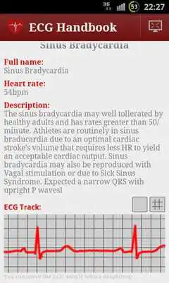 Play Heart ECG Handbook - Lite