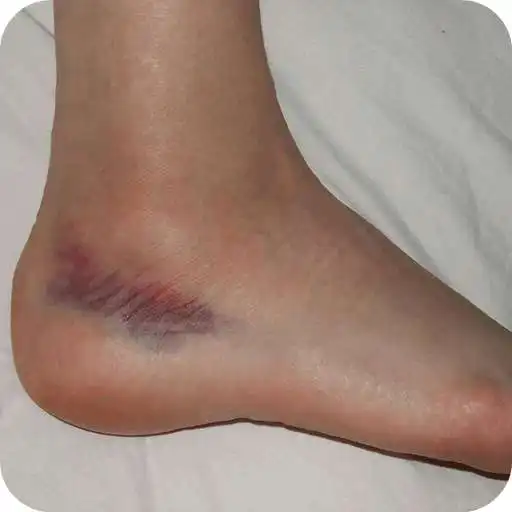 Play Heelpain Home Remedies APK