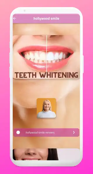 Play hollywood smile  and enjoy hollywood smile with UptoPlay
