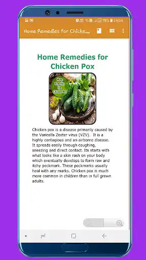 Play Home Remedies for Chicken Pox as an online game Home Remedies for Chicken Pox with UptoPlay
