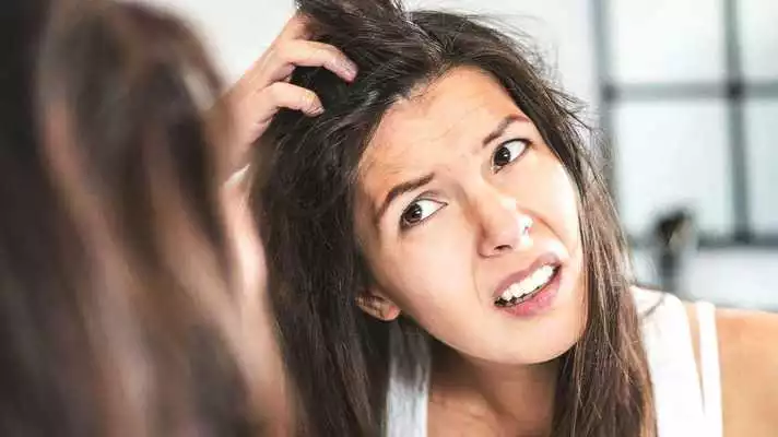 Play Home remedies for dandruff