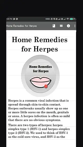 Play Home Remedies for Herpes as an online game Home Remedies for Herpes with UptoPlay
