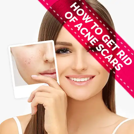 Play HOW TO GET RID OF ACNE SCARS APK