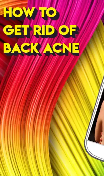 Play how to get rid of back acne  and enjoy how to get rid of back acne with UptoPlay