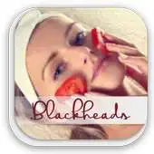 Free play online How To Get Rid Of Blackheads APK
