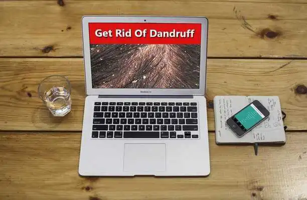 Play How to Get Rid of Dandruff (Natural Methods)