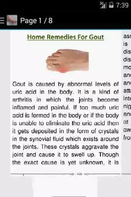 Play How to Get Rid of Gout