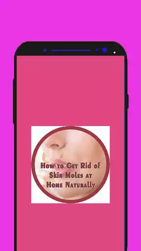 Play How to Get Rid of Skin Moles at Home Naturally  and enjoy How to Get Rid of Skin Moles at Home Naturally with UptoPlay