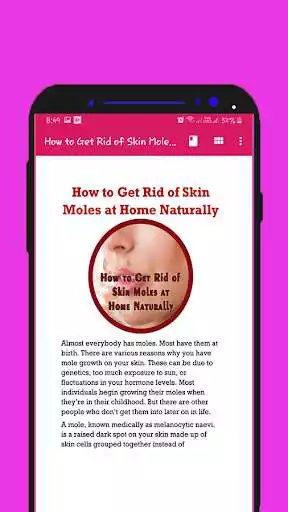 Play How to Get Rid of Skin Moles at Home Naturally as an online game How to Get Rid of Skin Moles at Home Naturally with UptoPlay