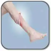 Free play online How to Prevent Leg Cramps APK