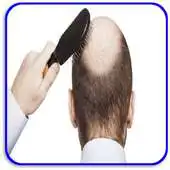 Free play online How to Treat Male Pattern Hair Loss APK