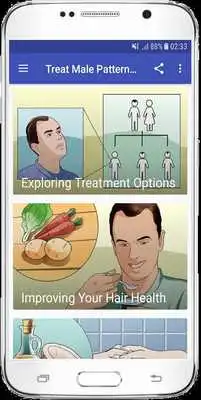 Play How to Treat Male Pattern Hair Loss