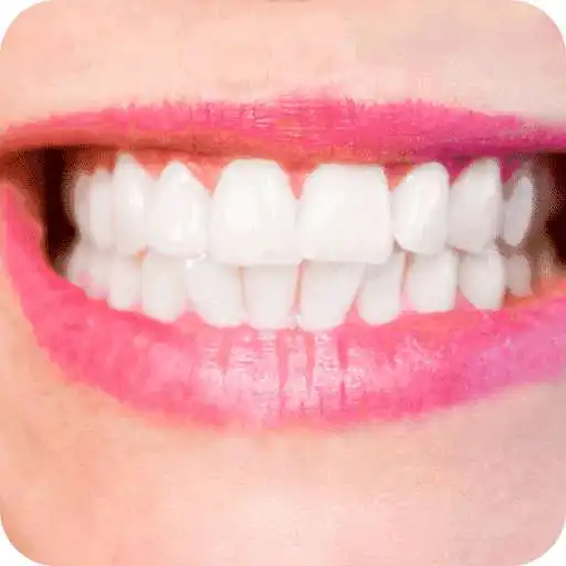 Free play online How to Whiten Teeth Instantly APK