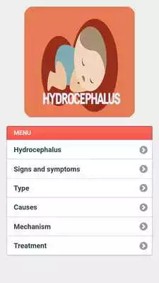 Play Hydrocephalus Disease