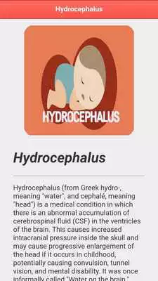Play Hydrocephalus Disease