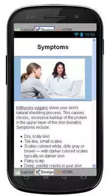 Play Ichthyosis Vulgaris Disease