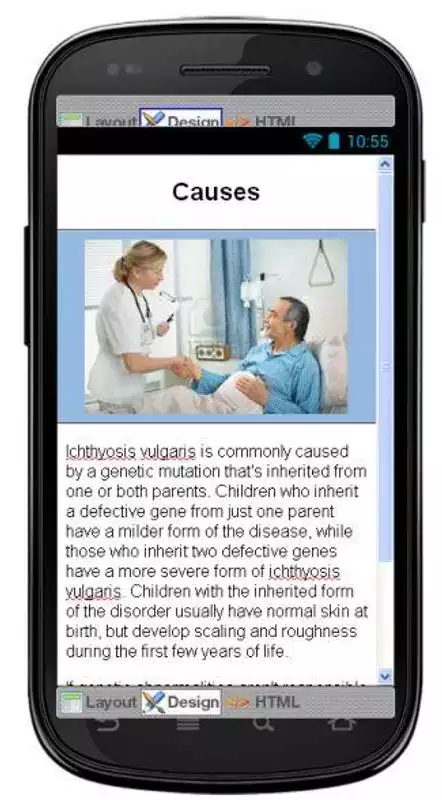Play Ichthyosis Vulgaris Disease