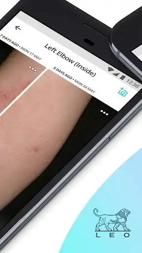 Play Imagine Skin Condition Tracker as an online game Imagine Skin Condition Tracker with UptoPlay