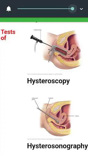 Play Infertility and its Management as an online game Infertility and its Management with UptoPlay