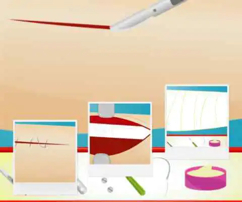 Play Internal surgery Play Internal surgery