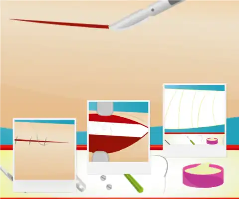 Play Internal surgery Play Internal surgery