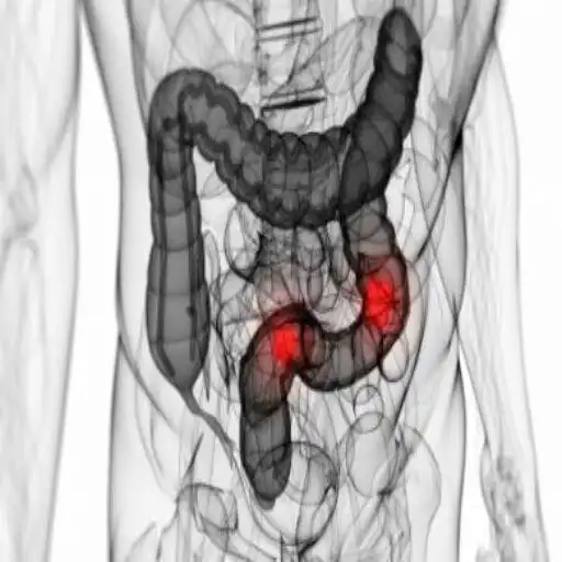 Play Irritable bowel cure APK