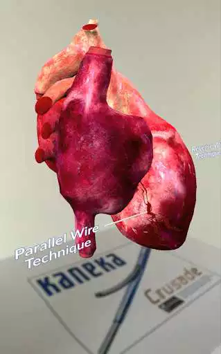 Play Kaneka Medical Products
