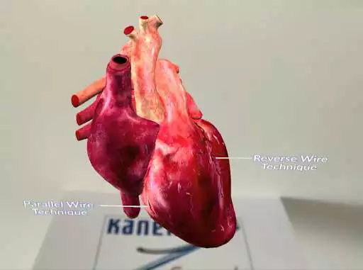 Play Kaneka Medical Products