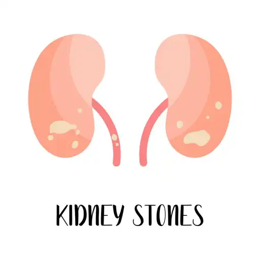 Play Kidney Stones and Treatment APK