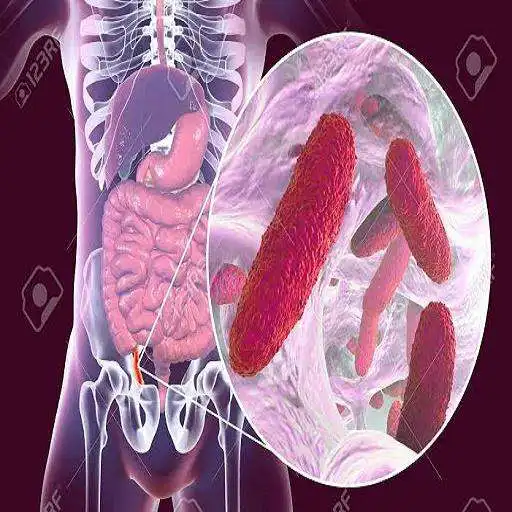 Play Klebsiella Pneumoniae APK