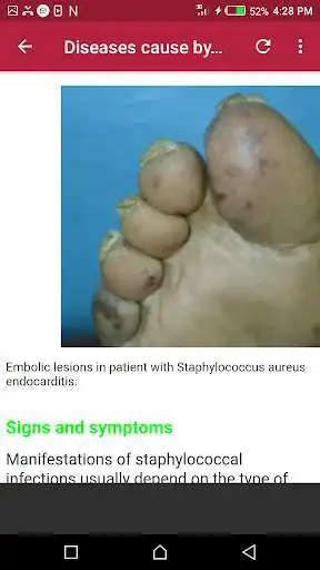 Play Klebsiella Pneumoniae as an online game Klebsiella Pneumoniae with UptoPlay