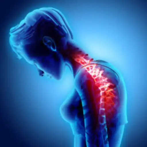 Play kyphosis exercise rounded back APK Play kyphosis exercise rounded back APK
