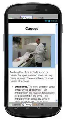 Play Lazy Eye Disease Symptoms Play Lazy Eye Disease Symptoms