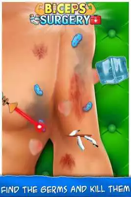 Play Learn how to Operate Biceps Surgery