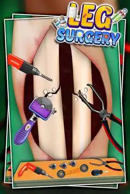 Play Leg Surgery Play Leg Surgery