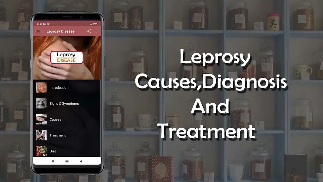 Play Leprosy - Causes, Diagnosis, a  and enjoy Leprosy - Causes, Diagnosis, a with UptoPlay