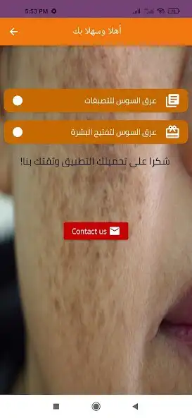 Play Licorice for pigmentation as an online game Licorice for pigmentation with UptoPlay