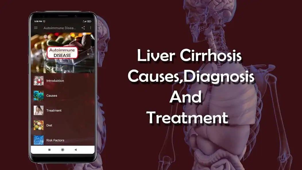 Play Liver Cirrhosis - Causes, Diag  and enjoy Liver Cirrhosis - Causes, Diag with UptoPlay