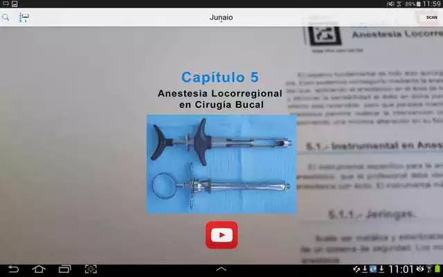 Play lpcb5 Play lpcb5