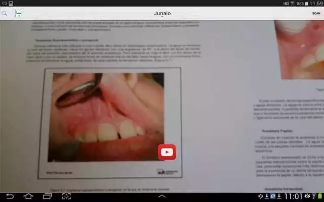 Play lpcb5 Play lpcb5