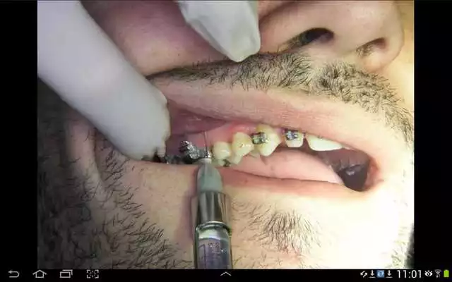 Play lpcb5 Play lpcb5