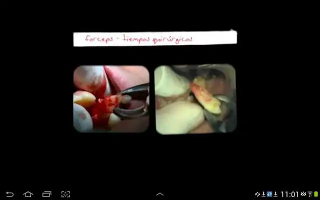 Play lpcb7 Play lpcb7