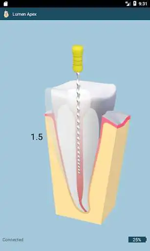 Play Lumen Apex Bluetooth as an online game Lumen Apex Bluetooth with UptoPlay