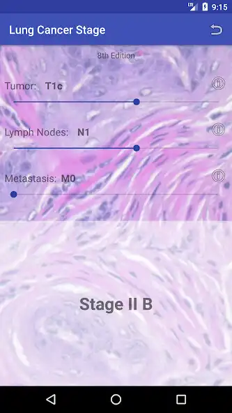Play Lung Cancer Stage  and enjoy Lung Cancer Stage with UptoPlay