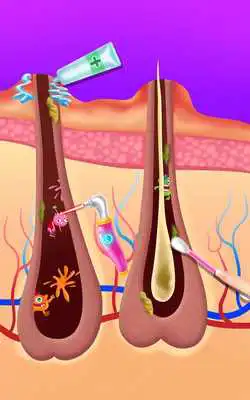 Play Makeup Artist - Pimple Salon