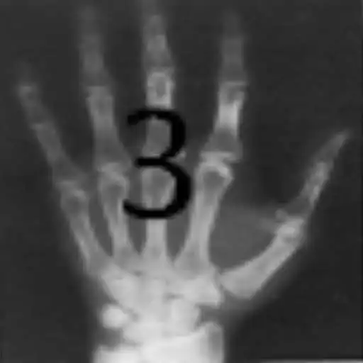 Play MANUAL RADIOLOGIA 3 APK Play MANUAL RADIOLOGIA 3 APK