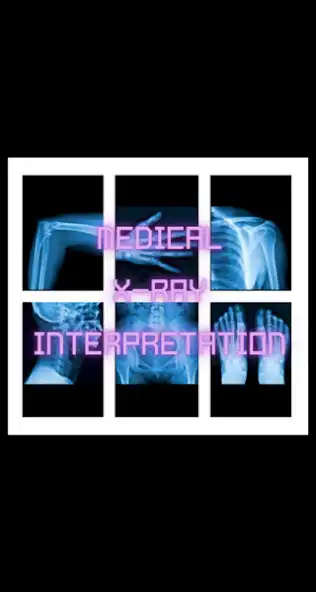 Play Medical X-Ray Interpretation I  and enjoy Medical X-Ray Interpretation I with UptoPlay