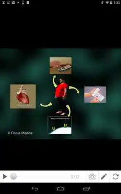 Play Metabolic Syndrome
